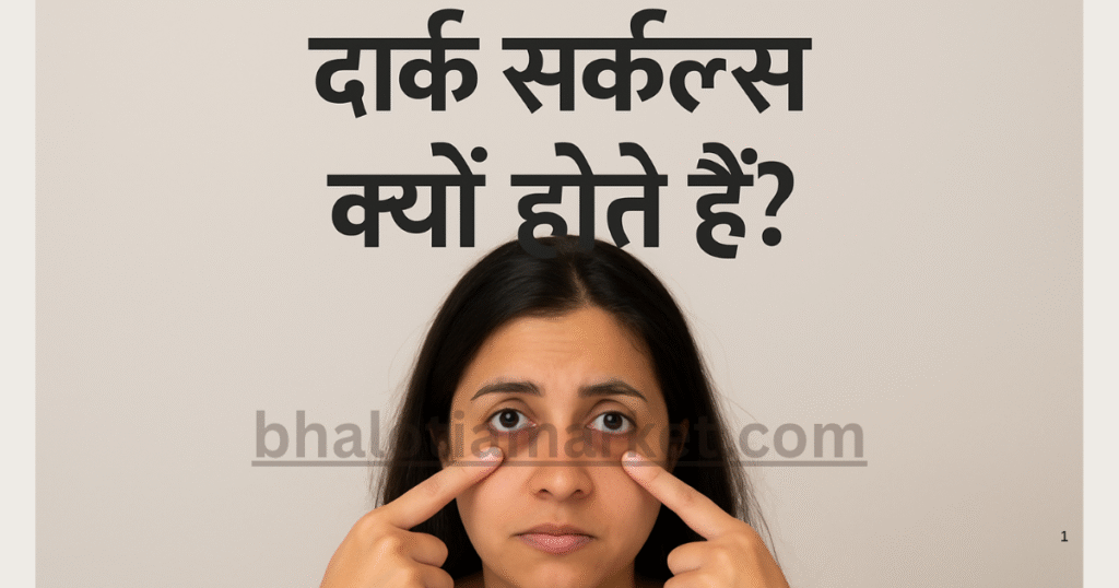 डार्क सर्कल्स क्यों होते हैं