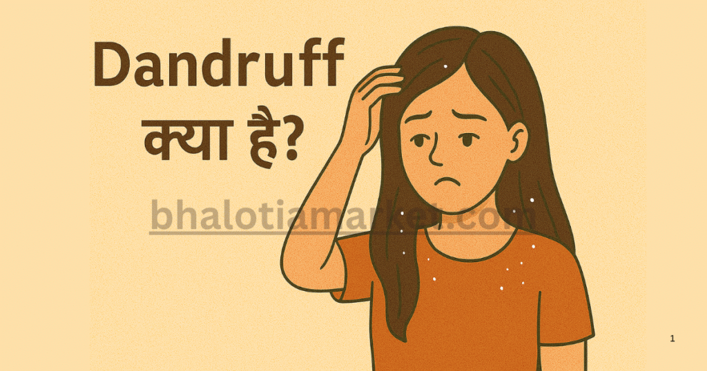 Dandruff क्या है?