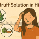 Dandruff Solution in Hindi