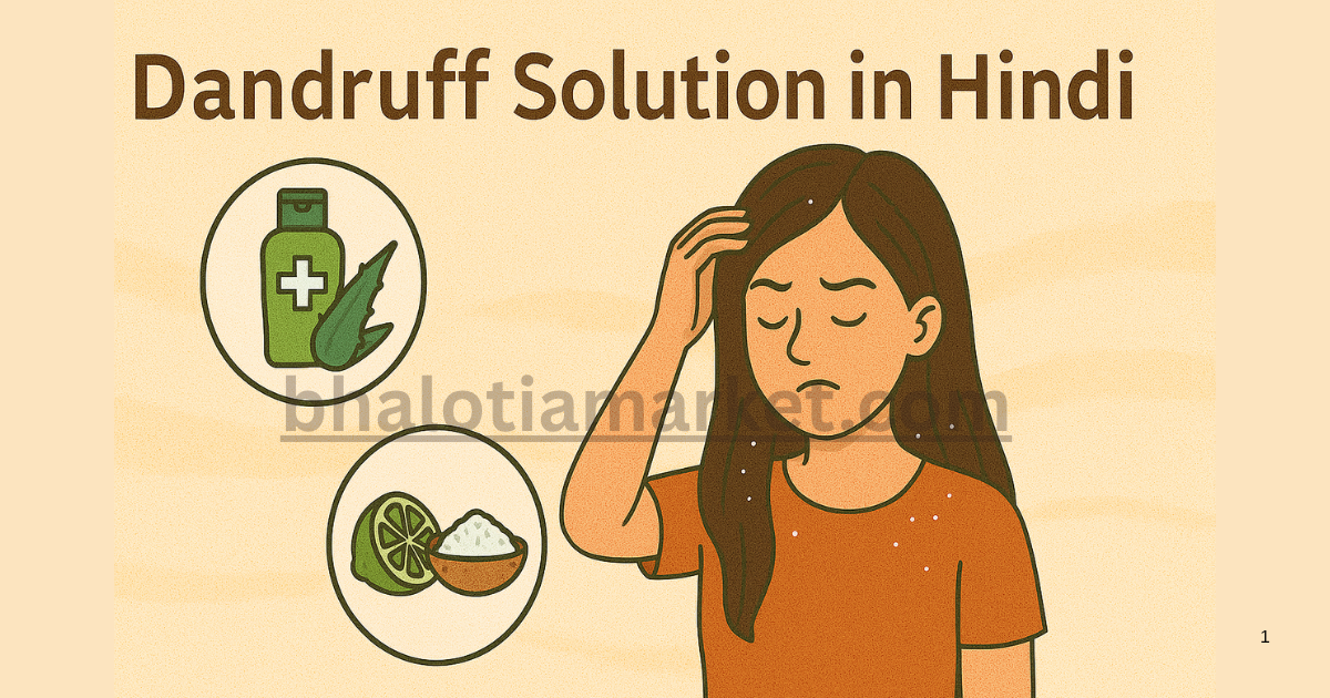 Dandruff Solution in Hindi – जानिए रुसी से छुटकारा पाने के असरदार घरेलू उपाय