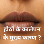 Lips Pink Kaise Kare