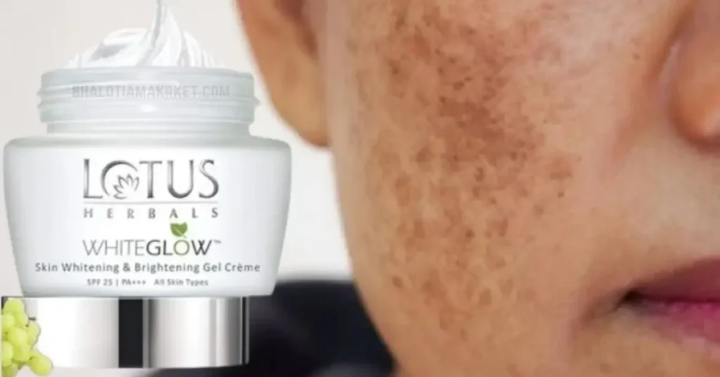 लोटस क्रीम के नुकसान: मिडिल क्लास और गरीब परिवारों को ज़रूर जानना चाहिए ये बातें 13 लोटस क्रीम के नुकसान