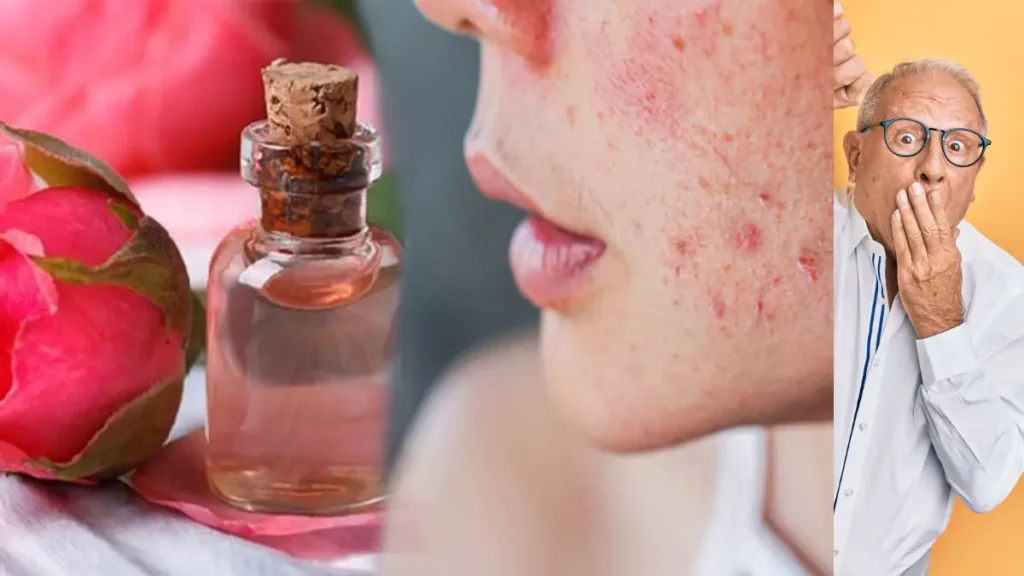 Gulab Jal Lagane Ke Fayde – चेहरे की खूबसूरती और सेहत का राज़ 14 gulab jal lagane ke fayde